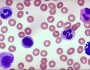 Neutrophil vs. monocyte