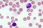 Anemia quiz