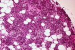 What does normal parathyroid tissue look like?
