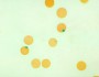 Glucose 6 phosphate dehydrogenase deficiency
