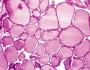 Thyroid lab tests explained in under 150 words