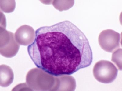 http://www.pathologystudent.com/wp-content/uploads/2009/04/cropped-auer-rod-2.jpg