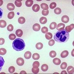 leukocytes