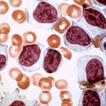 cll