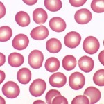 normal-blood1