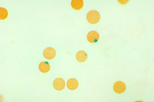 What’s the difference between Howell-Jolly bodies and Heinz bodies?