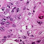 Intercellular bridging