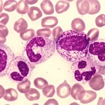 myelocyte 1
