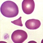 Triangulocyte