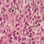 mitoses