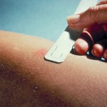 Mantoux