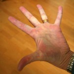 Hand 1
