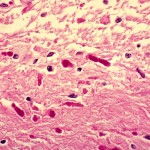 Unknown case