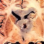 Unknown case