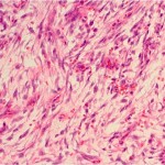 Unknown case 9