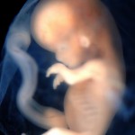 fetus