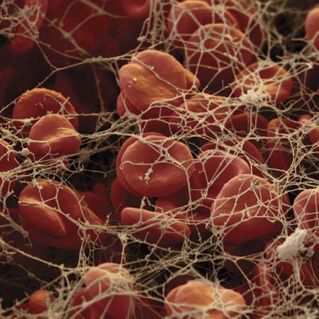 fibrin