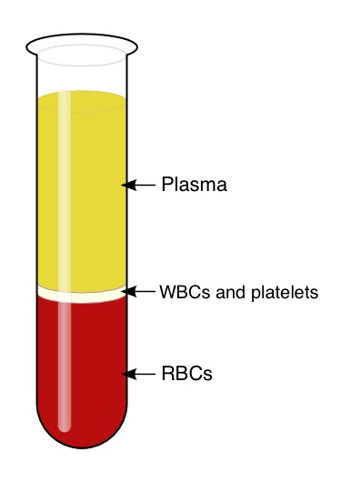 Serum vs. plasma